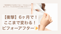 【衝撃】6ヶ月でここまで変わる!美容整形級ビフォーアフター✨