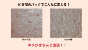 整肌・お仕上げ